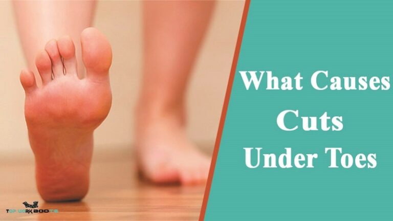 what-causes-cuts-under-toes